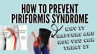 Preventing Piriformis Syndrome: Tips for Active Lifestyles - Hempure