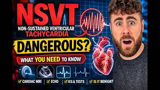Is NSVT Dangerous? (Non-Sustained Ventricular Tachycardia Explained)