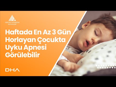 Haftada En Az 3 Gün Horlayan Çocuğa Dikkat; Uyku Apnesi Görülebilir