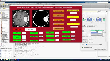Multi Classification of Brain Tumor MRI Images Using Deep Convolutional Neural Network with Fully Op