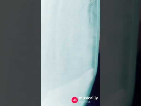 اويلي يا ويلي من اين كل هل جمال كانو ماخده شويه جمال من عند الادالبي