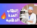 إلتهاب الجفن المزمن   