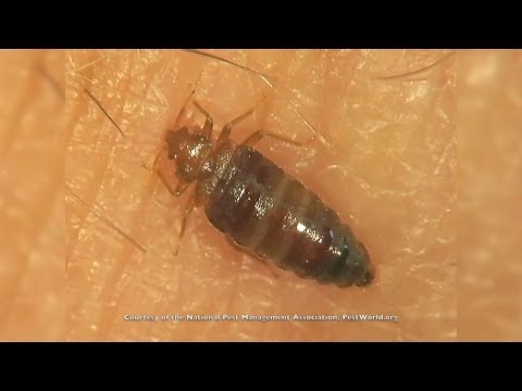 Video: Vai Jūs Varat Redzēt Bedbugs: Izmērs, Identifikācija, Noņemšana, Novēršana