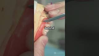 The Unsung Heroes Behind Your Smile: Dental Technicians