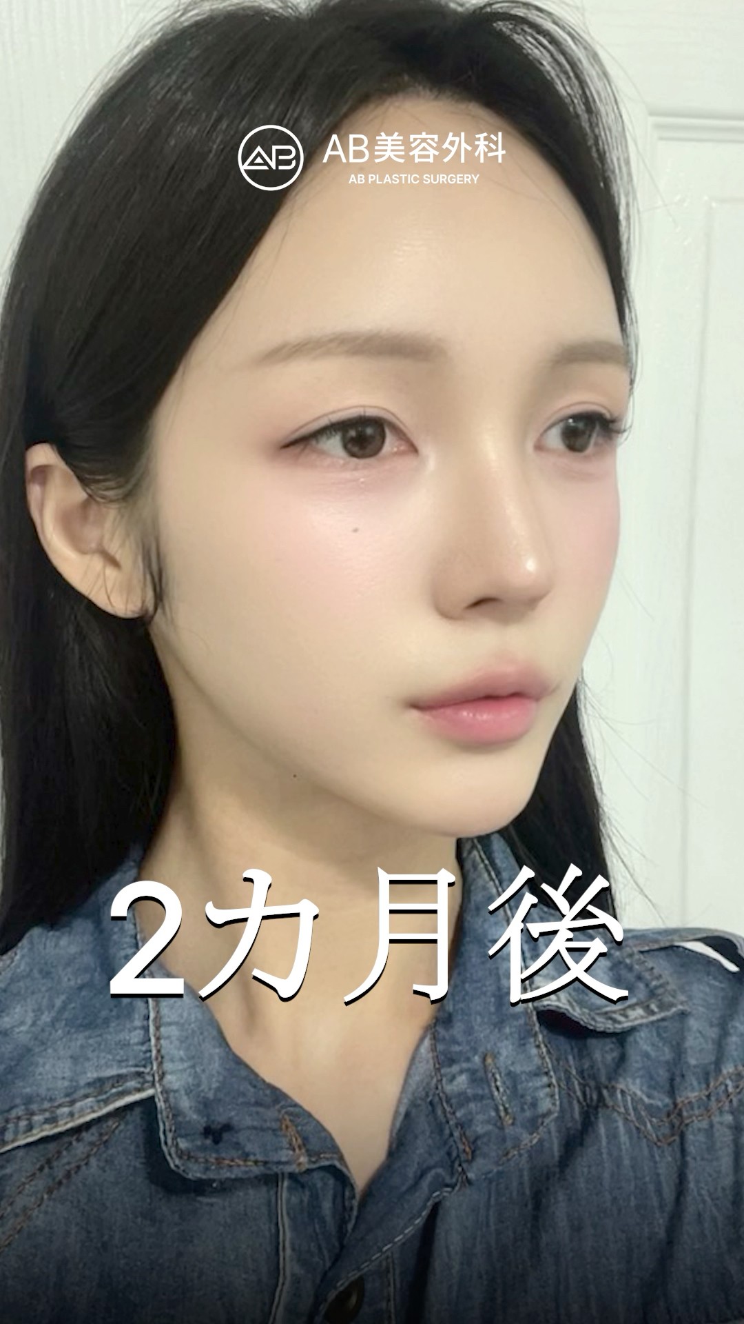 整形で“彼”が美しい“彼女”に…！ #shorts