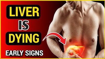 7 Signs of LIVER DISEASE You Can See: Science Explains