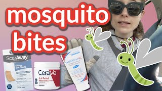 How to fade mosquito bites and stop the itch | Dr Dray