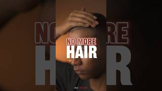 മുടി മുഴുവനും പോകും 😭hair growth serum for men #shorts