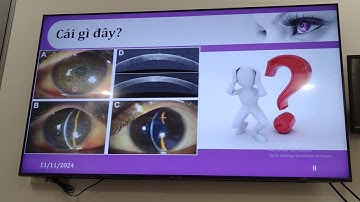 Lớp tiếng anh chuyên ngành nhãn khoa - Buổi 1