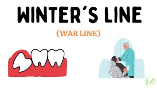 Winter's Line | War line | Impaction | Oral surgery | Medinare