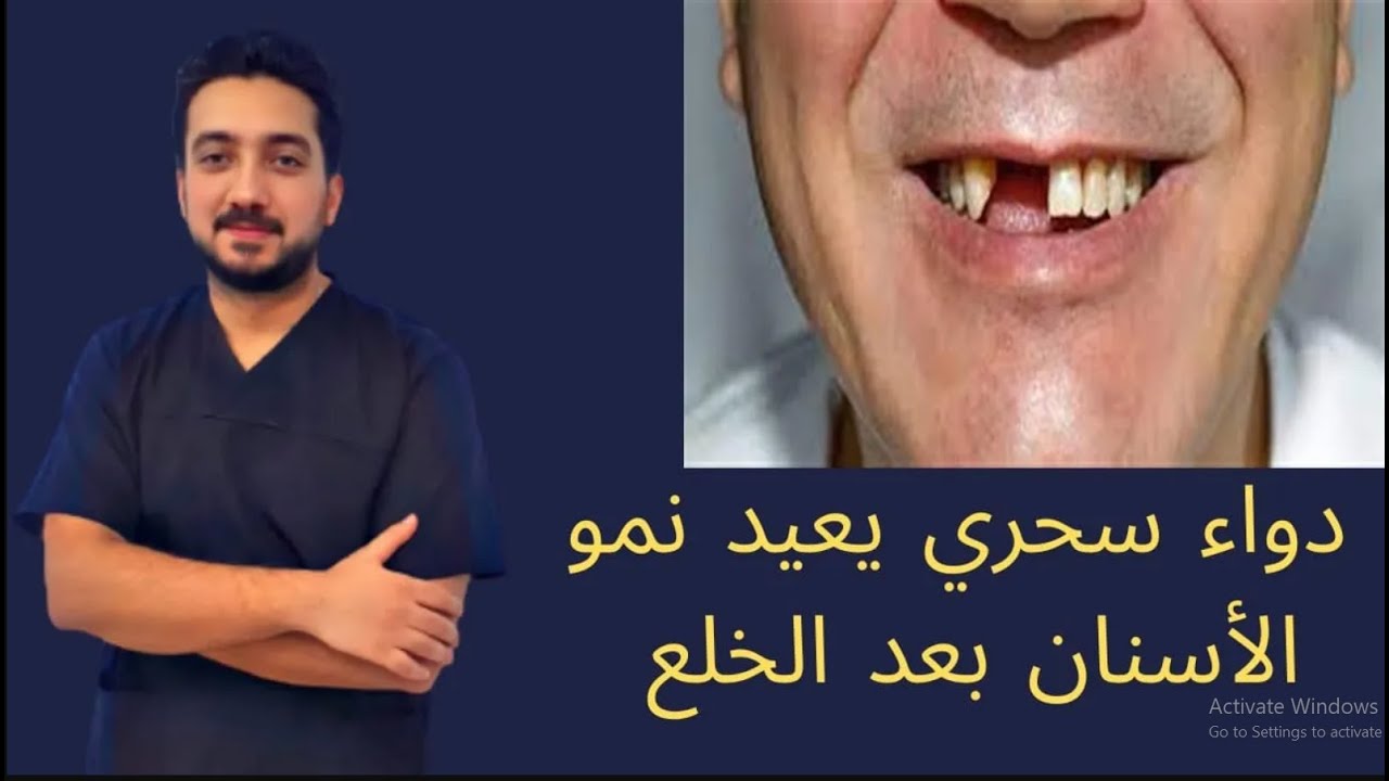 دواء سحري يعيد نمو الأسنان بعد الخلع (الدليل الشامل)