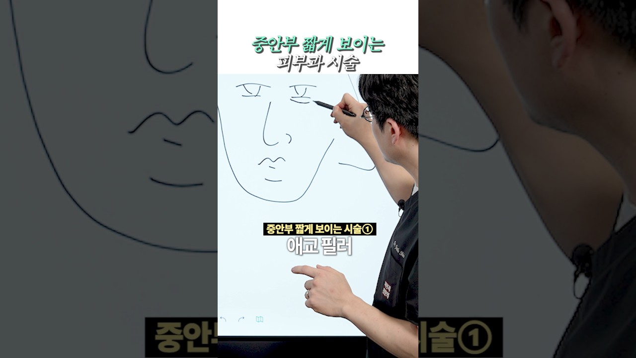 중안부 짧아보이는 시술