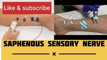 SAPHENOUS SENSORY NERVE | NCS of Saphenous nerve #emg #neurology #NCS #neurotech @The_neurotech