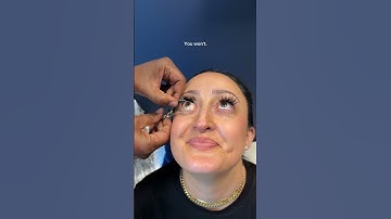 How we keep your eye open during Laser eye surgery