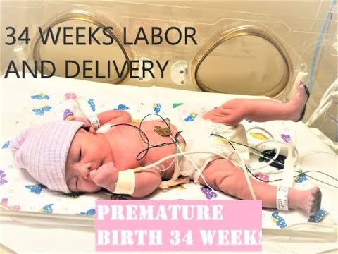 premature 34 weeks