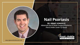 Nail Psoriasis | Dr. Grant Gonzalez | Foot & Ankle Center of Illinois