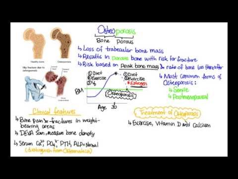 What Osteoporosis P