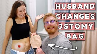 Husband Changes My Ostomy Bag... FOR THE FIRST TIME EVER! | Let's Talk IBD
