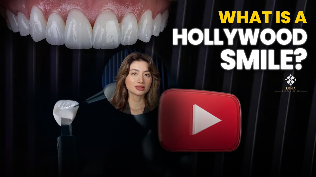🤍 Что такое голливудская улыбка? — Стоматологическая клиника Lema