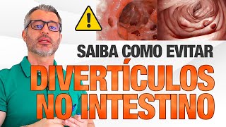 O que você precisa saber para não ter uma DIVERTICULITE