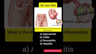 What is the medical term for inflammation of the appendix?