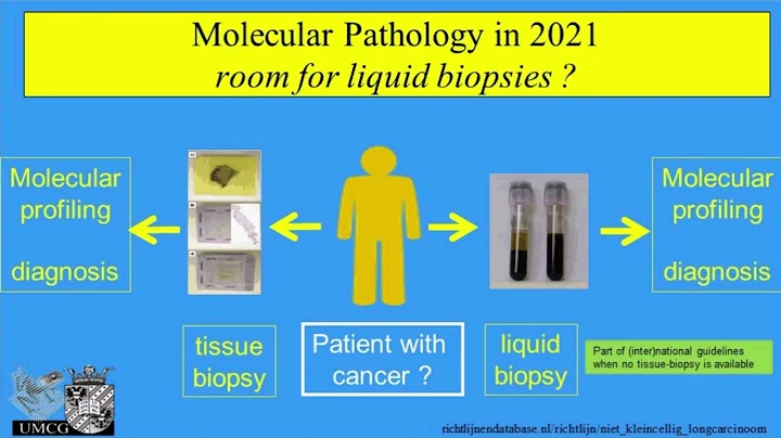 Webinar: Detection of therapeutically targetable mutations in NSCLC