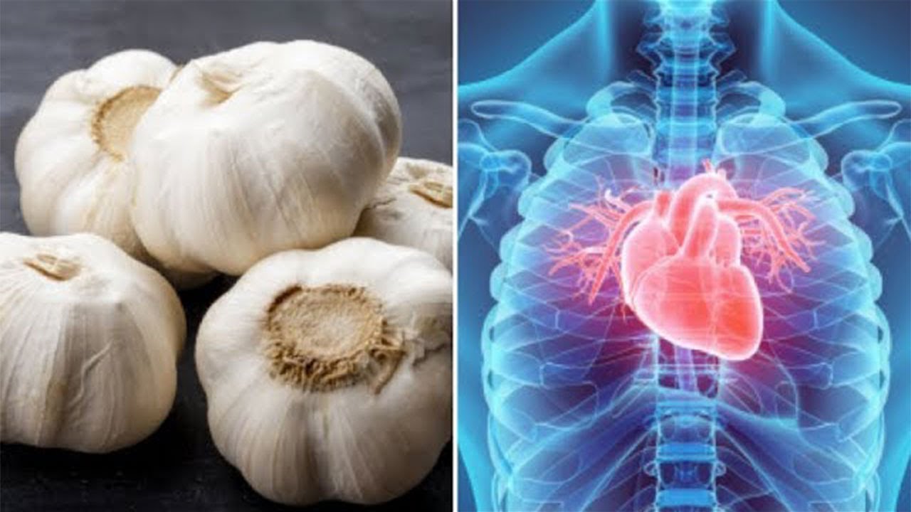 5 Wundermittel mit Knoblauch, die dich überraschen werden! 5 Wundermittel mit Knoblauch, die dich überraschen werden!