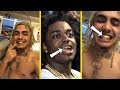 Lil Pump Gets A Kodak Black Grill After Getting His Braces Off!