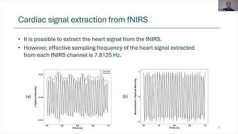 Detecting Learning Disorders by Extracting Heart Signals from NIRS