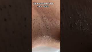 How To Get Smooth White Underarm Skin????