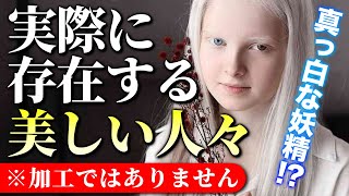 【アルビノ✖️オッドアイ】実在するユニークな美を持つ人たち【加工なし】