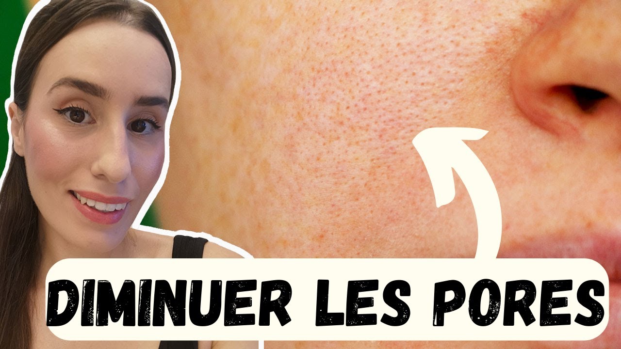 COMMENT DIMINUER LA TAILLE DES PORES  POURQUOI NOS PORES SLARGISSENT 