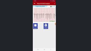 Demo Polar ECG Analysis App screenshot 1