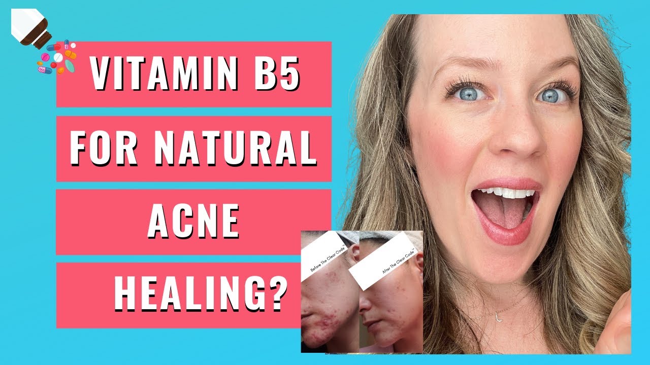 Vitamin B5 and acne HORMONAL ACNE TREATMENT? YouTube