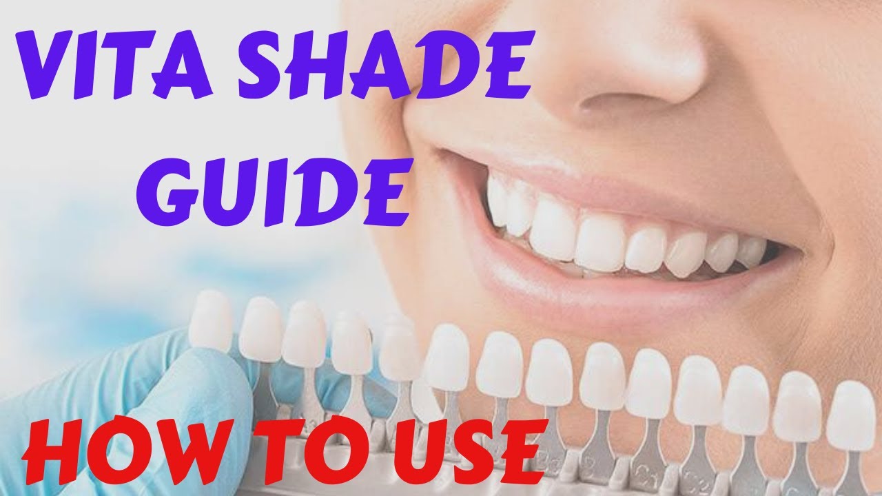 Tooth Shade Conversion Chart