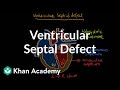 Ventricular septal defect | Circulatory System and Disease | NCLEX-RN | Khan Academy