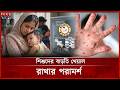 'টিকার সুফলে হামের প্রভাব কমেছে' | Measles | Ham Update | Somoy TV