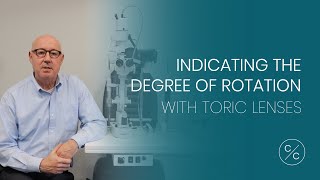 Indicating the Degree of Rotation with Toric Lenses | Contacts with Conway screenshot 5
