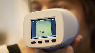 В Латвии тестируют устройство, позволяющее спасти больных меланомой