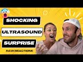The Surprising Ultrasound that Changes EVERYTHING! (Raw Reactions) image