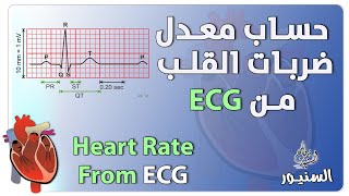 حساب معدل ضربات القلب من ورقة رسم القلب بطريقة سهلة جدا ECG screenshot 5