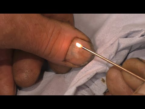 Beginner Blood Splatter Nail Art | Halloween Nail Tutorial | DIY Nails -  YouTube