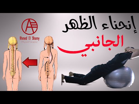 فيديو: 4 طرق للتخلص من بيض الدودة