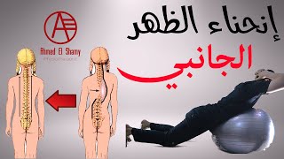 كيفية التخلص من الجنف | انحناء الظهر الجانبي - Scoliosis