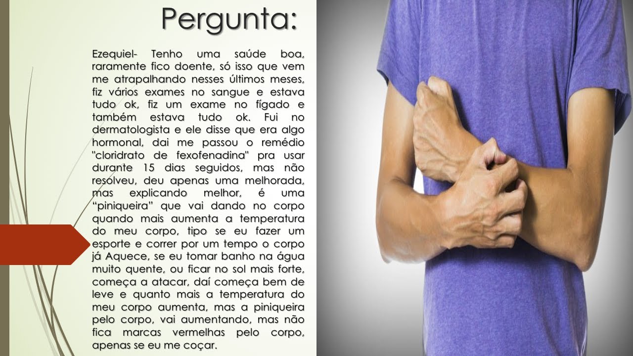 Meu corpo pinica toda vez que aquece | Não posso ficar no sol e tomar ...