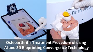 [Cartilage Regeneration] Osteoarthritis Treatment Procedure of using AI and 3D Bioprinting