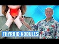 Thyroidnodules  acupressure in 60 seconds