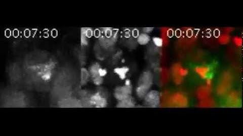 Spindle assembly checkpoint inactivation fails to suppress neuroblast tumour formation in aurA...