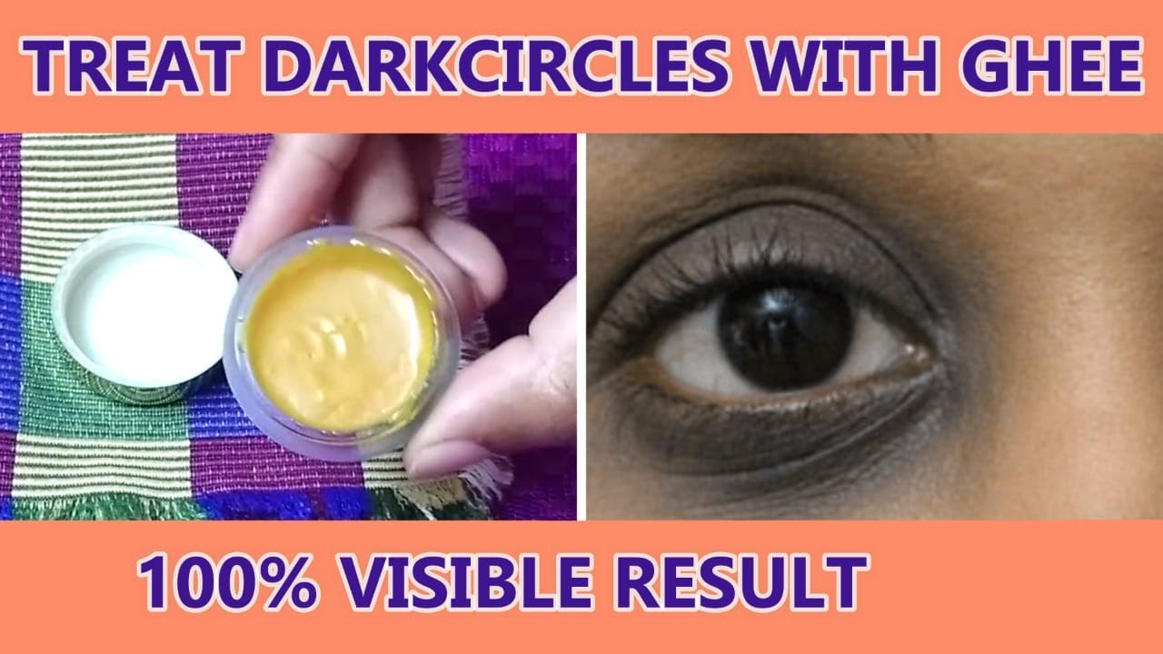How to remove undereye Dark circles with GHEE within 1 month100