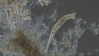 Rotifer